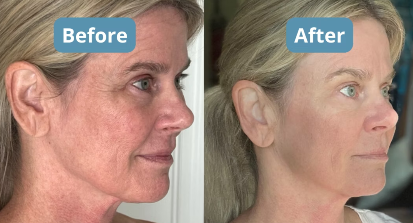 Total Night Cream Benefits