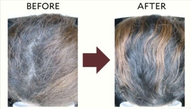 Purality Health Hair Renewal benefit