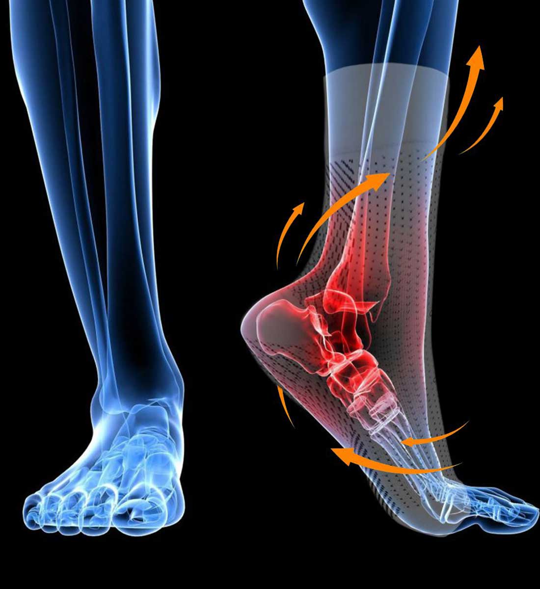 SoothRelieve Compression Socks Benefits
