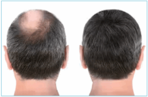 CelluHair Spray cus1