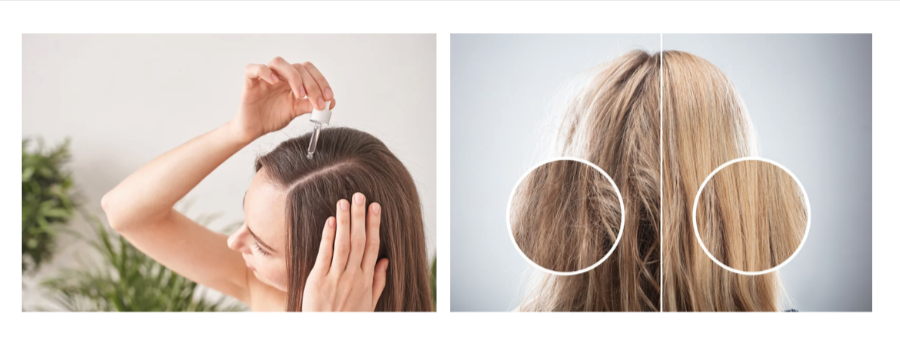 EverBella Essential Growth Hair Serum uses