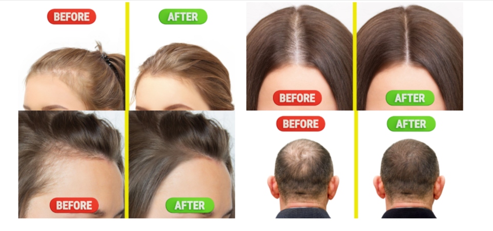 EverBella Essential Growth Hair Serum