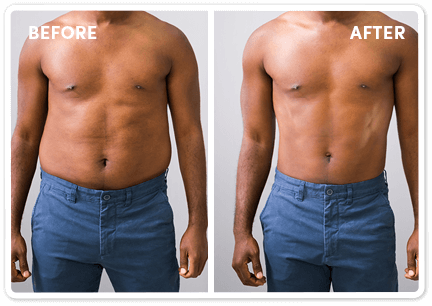 Smash IT Blood Sugar Benefits