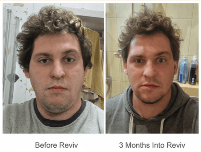 Reviv MouthGuard Customer Reviews