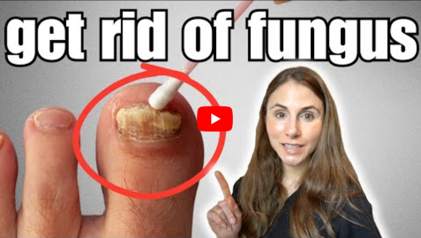 Rid of Toenail Fungus