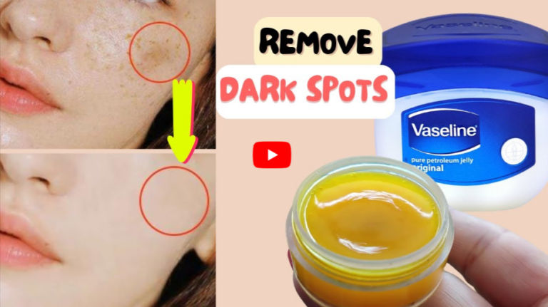 BakingSoda with Vaseline for Dark Spots