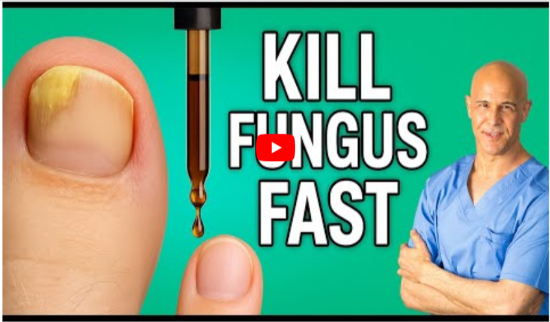 CastorOil for Nail Fungus