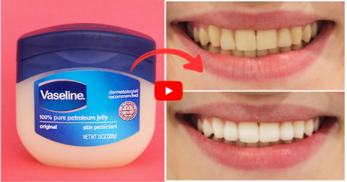 Vaseline Chocolate For Teeth