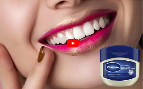 Vaseline With Chocolate For Tooth ache