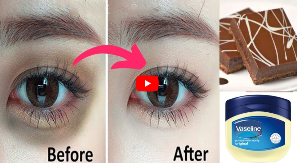 Vaseline With Chocolate For Under EyeDark Circles