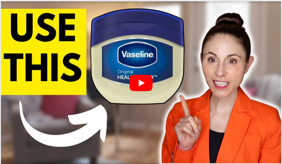 Vaseline With Chocolate Vitiligo