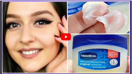 VicksVaporub For Acne