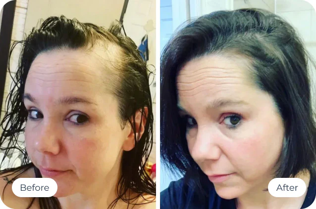 Scalpistry reviews after usage