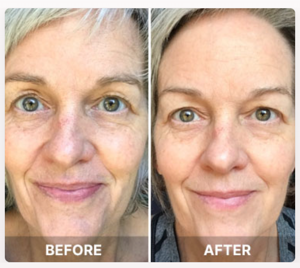 South Beach Collagen Filler Serum. results
