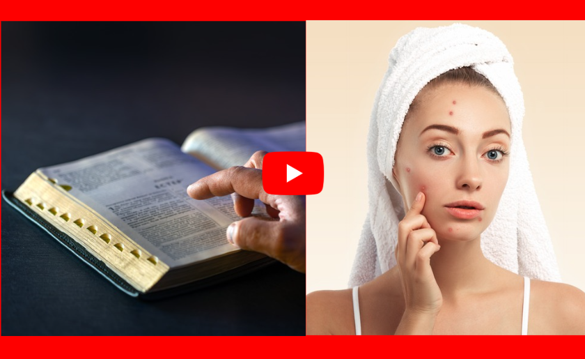 biblical cure for skin problems image 3