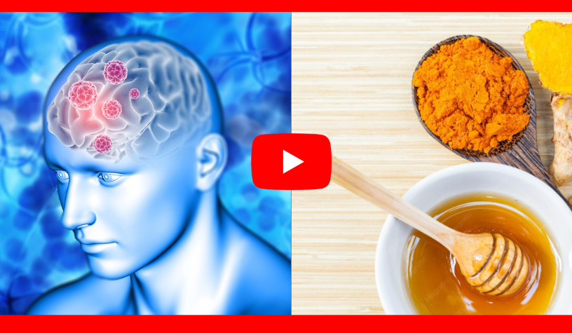 Brain Health