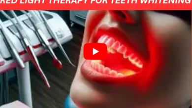 Red Light Therapy for Teeth Whitening image 1