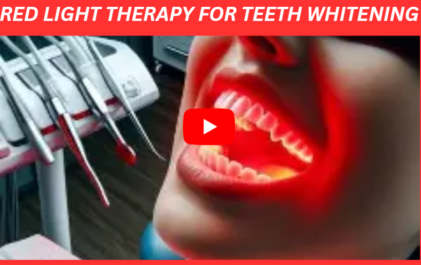 Red Light Therapy for Teeth Whitening image 1