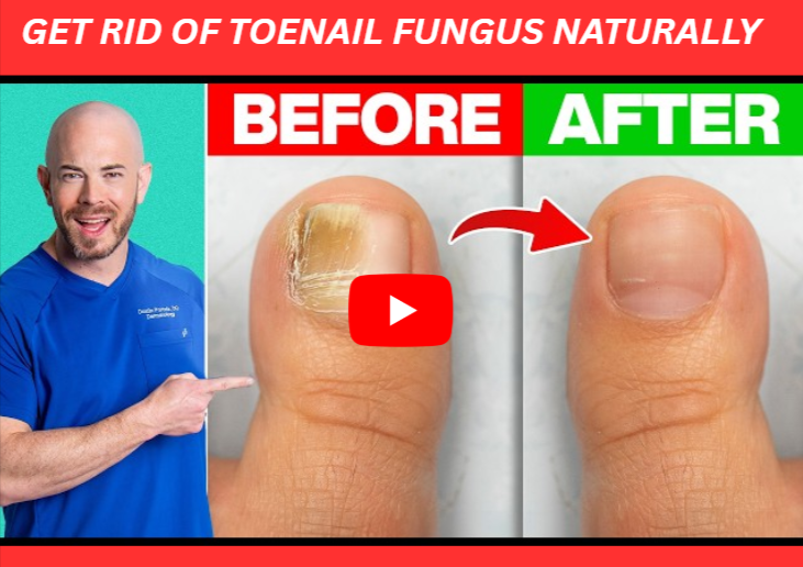 get rid of toenail fungus naturally
